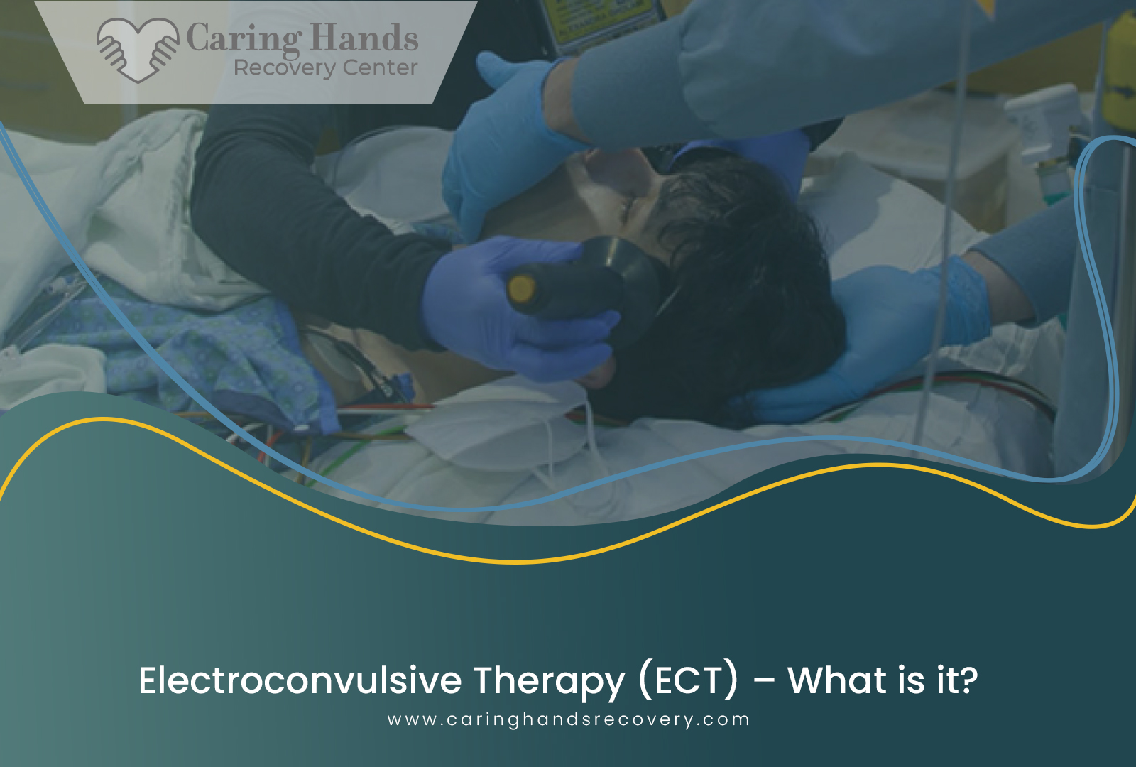 Electroconvulsive Therapy (ECT)_ What is it